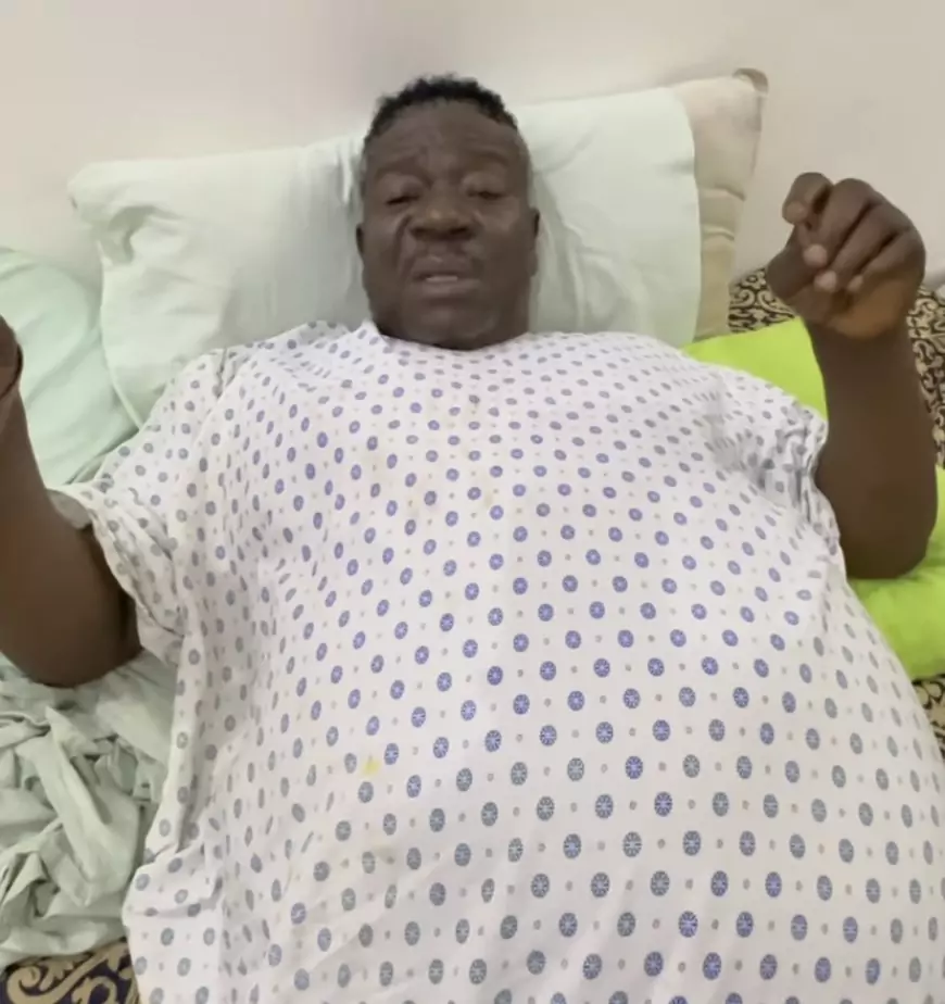 Al actor nigeriano Ibu le amputan la pierna tras su hospitalización